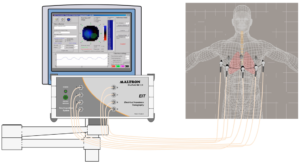 Electrical Impedance Tomography