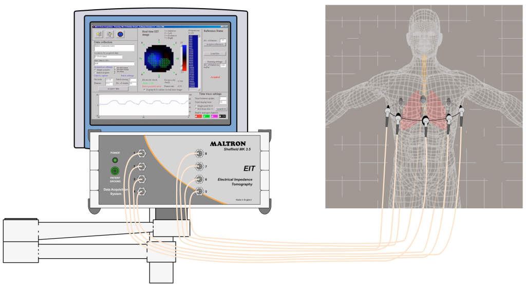 Electrical Impedance Tomography
