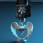 The Impact of 3D Printing in Healthcare Solutions