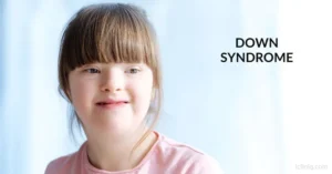 Down syndrome