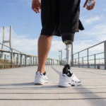 Prosthetics Services